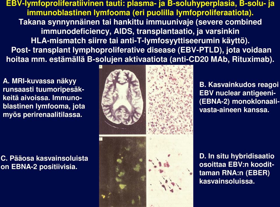 Post- transpant ymphoproiferative disease (EBV-PTLD), jota voidaan hoitaa mm. estämää B-soujen aktivaatiota (anti-cd20 MAb, Rituximab). A.