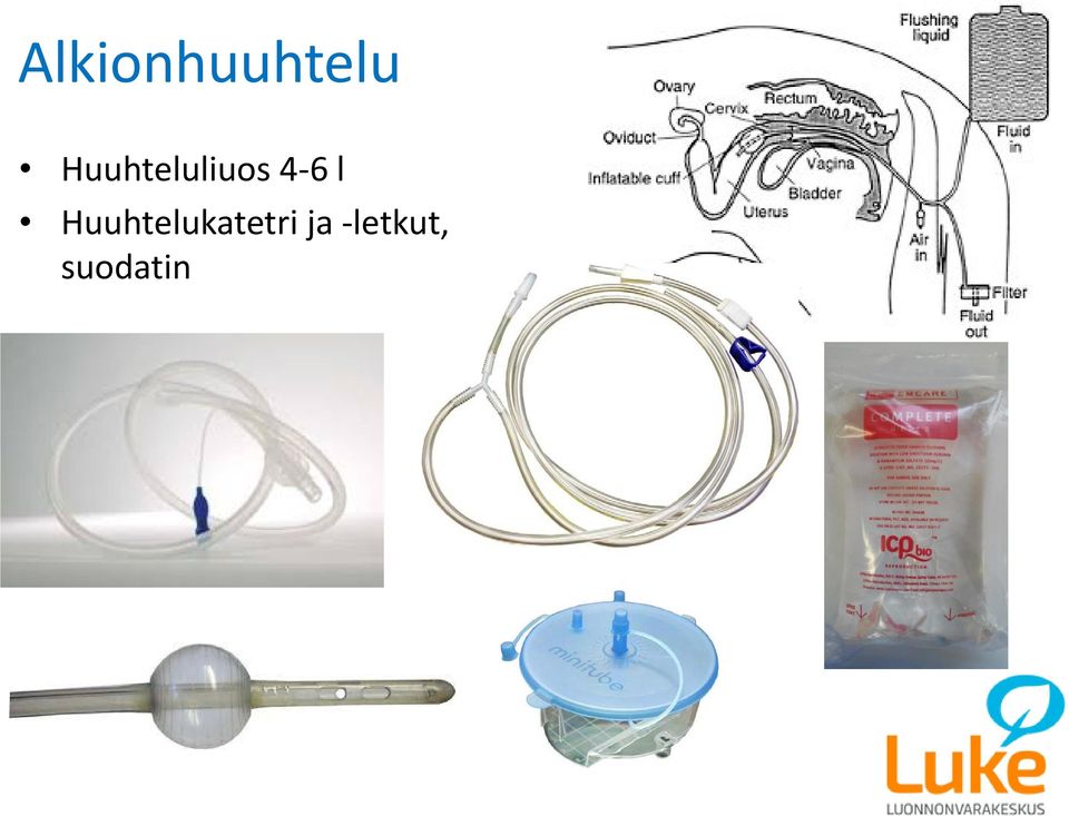 l Huuhtelukatetri