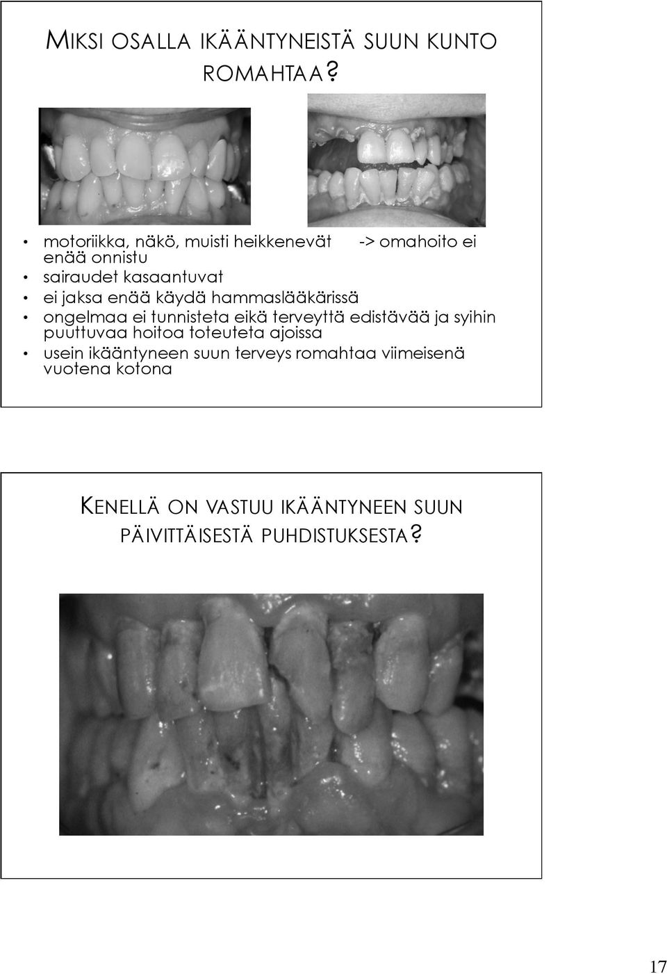 enää käydä hammaslääkärissä ongelmaa ei tunnisteta eikä terveyttä edistävää ja syihin puuttuvaa