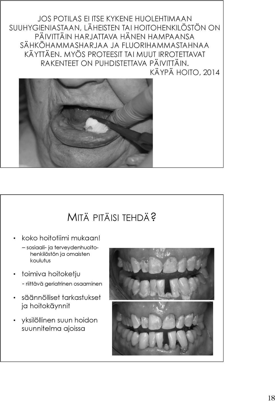 KÄYPÄ HOITO, 2014 MITÄ PITÄISI TEHDÄ? koko hoitotiimi mukaan!