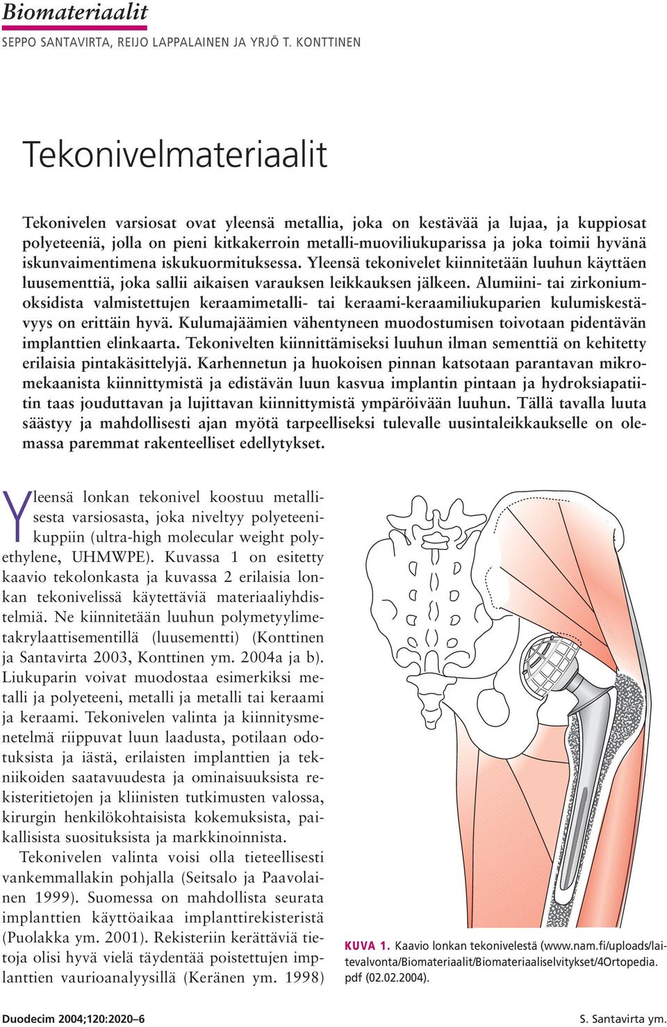 hyvänä iskunvaimentimena iskukuormituksessa. Yleensä tekonivelet kiinnitetään luuhun käyttäen luusementtiä, joka sallii aikaisen varauksen leikkauksen jälkeen.