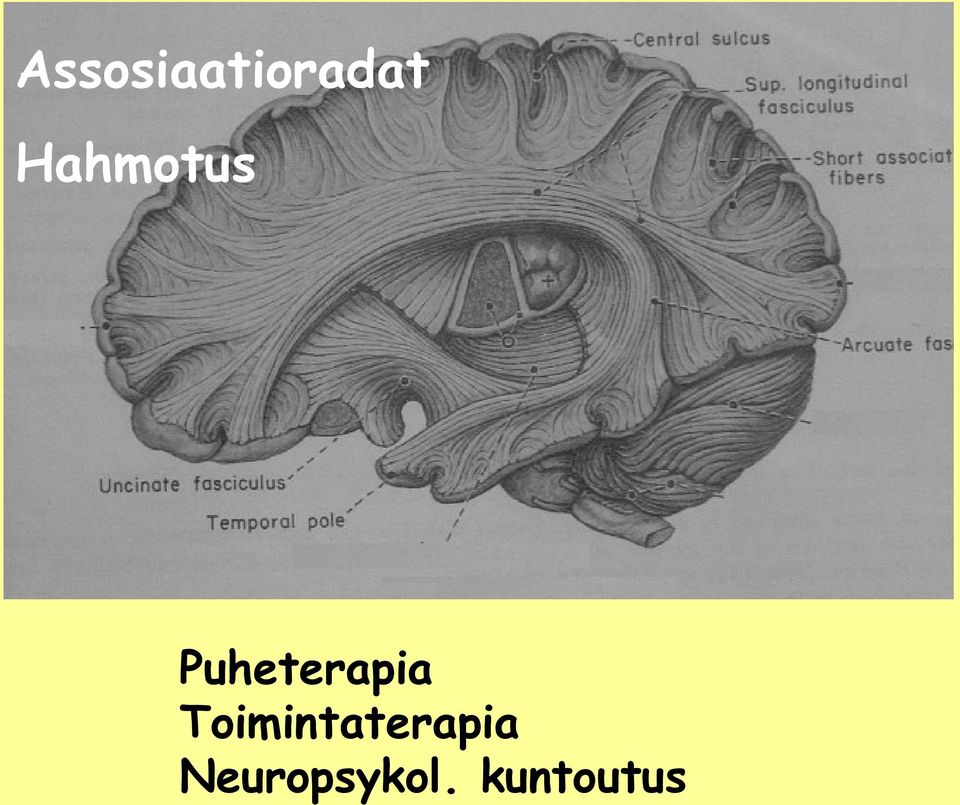 Puheterapia