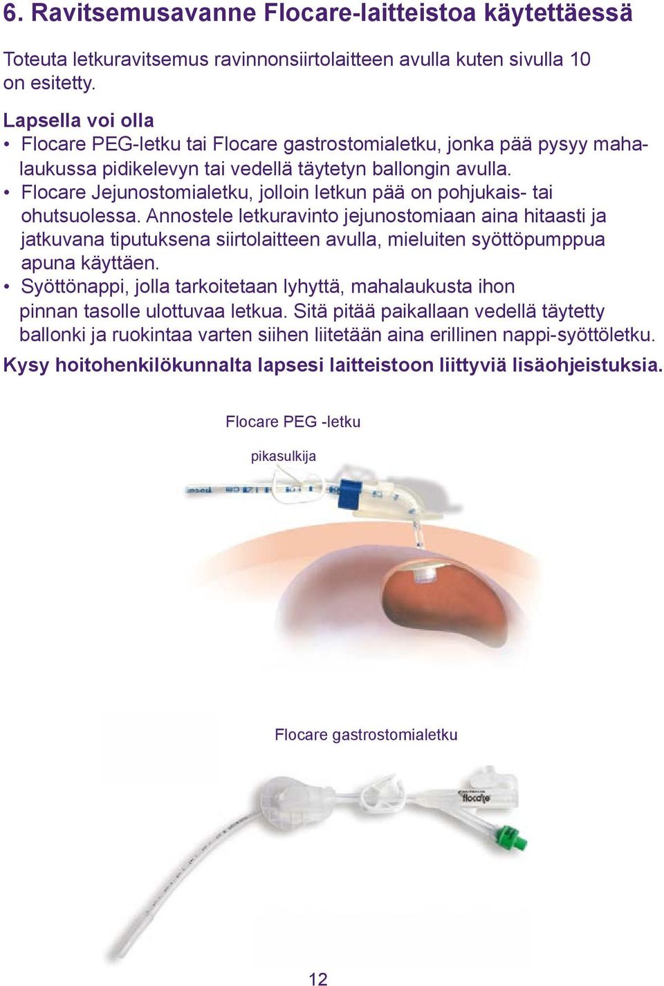 Flocare Jejunostomialetku, jolloin letkun pää on pohjukais- tai ohutsuolessa.