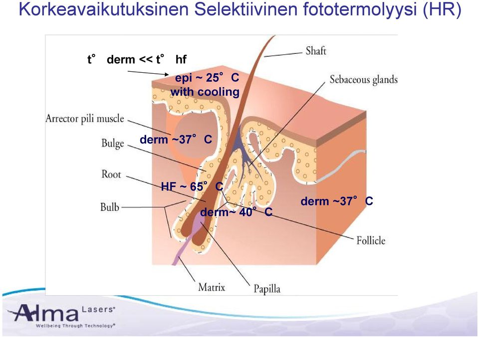 hf epi ~ 25 C with cooling derm