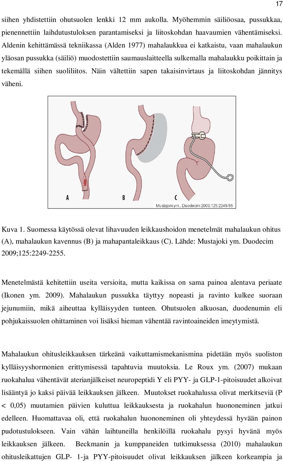 suoliliitos. Näin vältettiin sapen takaisinvirtaus ja liitoskohdan jännitys väheni. Kuva 1.