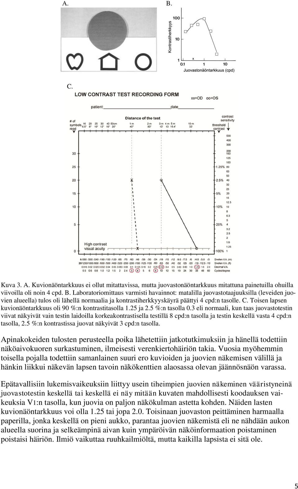 3 eli normaali, kun taas juovastotestin viivat näkyivät vain testin laidoilla korkeakontrastisella testillä 8 cpd:n tasolla ja testin keskellä vasta 4 cpd:n tasolla, 2.