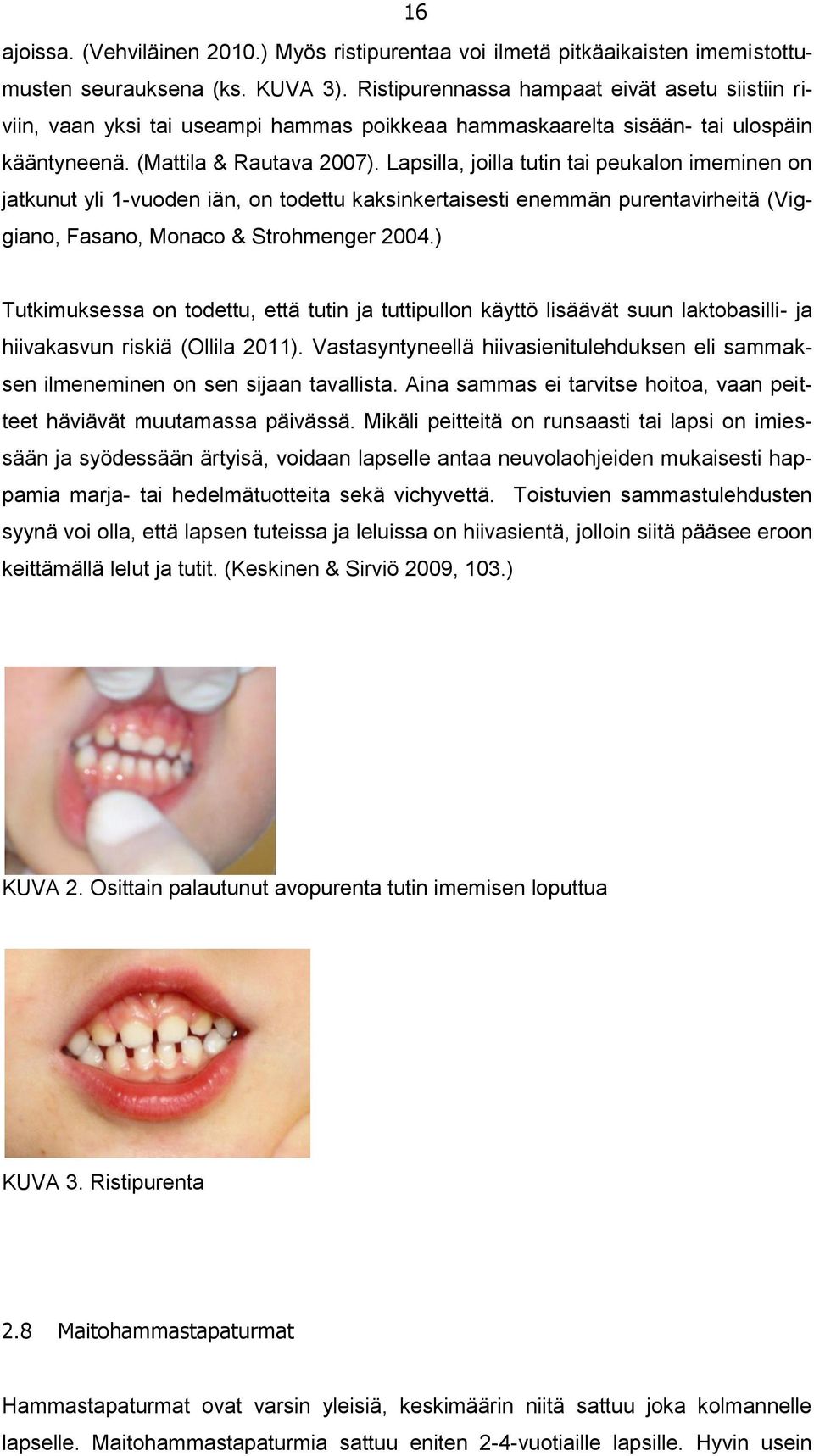 Lapsilla, joilla tutin tai peukalon imeminen on jatkunut yli 1-vuoden iän, on todettu kaksinkertaisesti enemmän purentavirheitä (Viggiano, Fasano, Monaco & Strohmenger 2004.