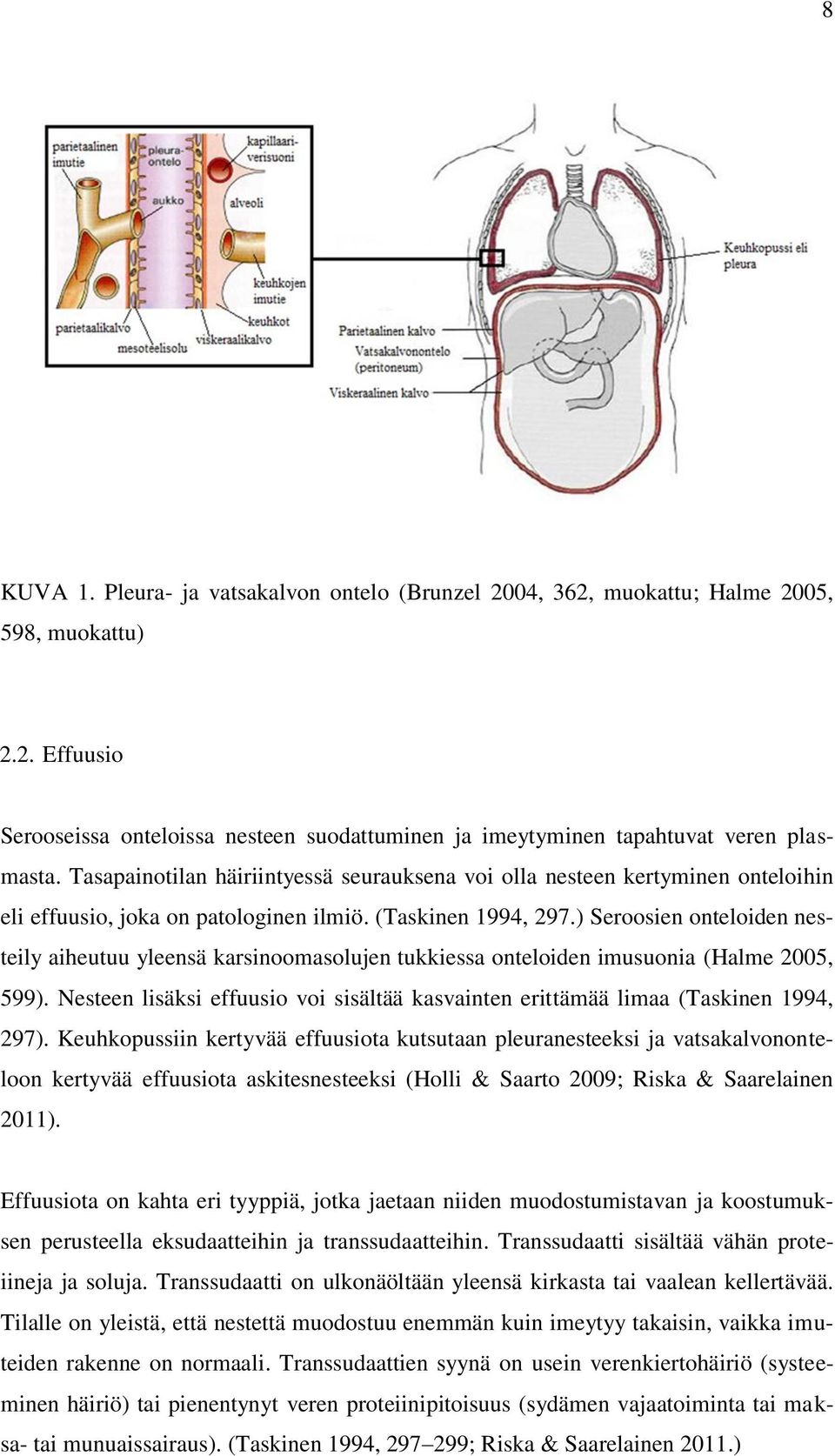 ) Seroosien onteloiden nesteily aiheutuu yleensä karsinoomasolujen tukkiessa onteloiden imusuonia (Halme 2005, 599).