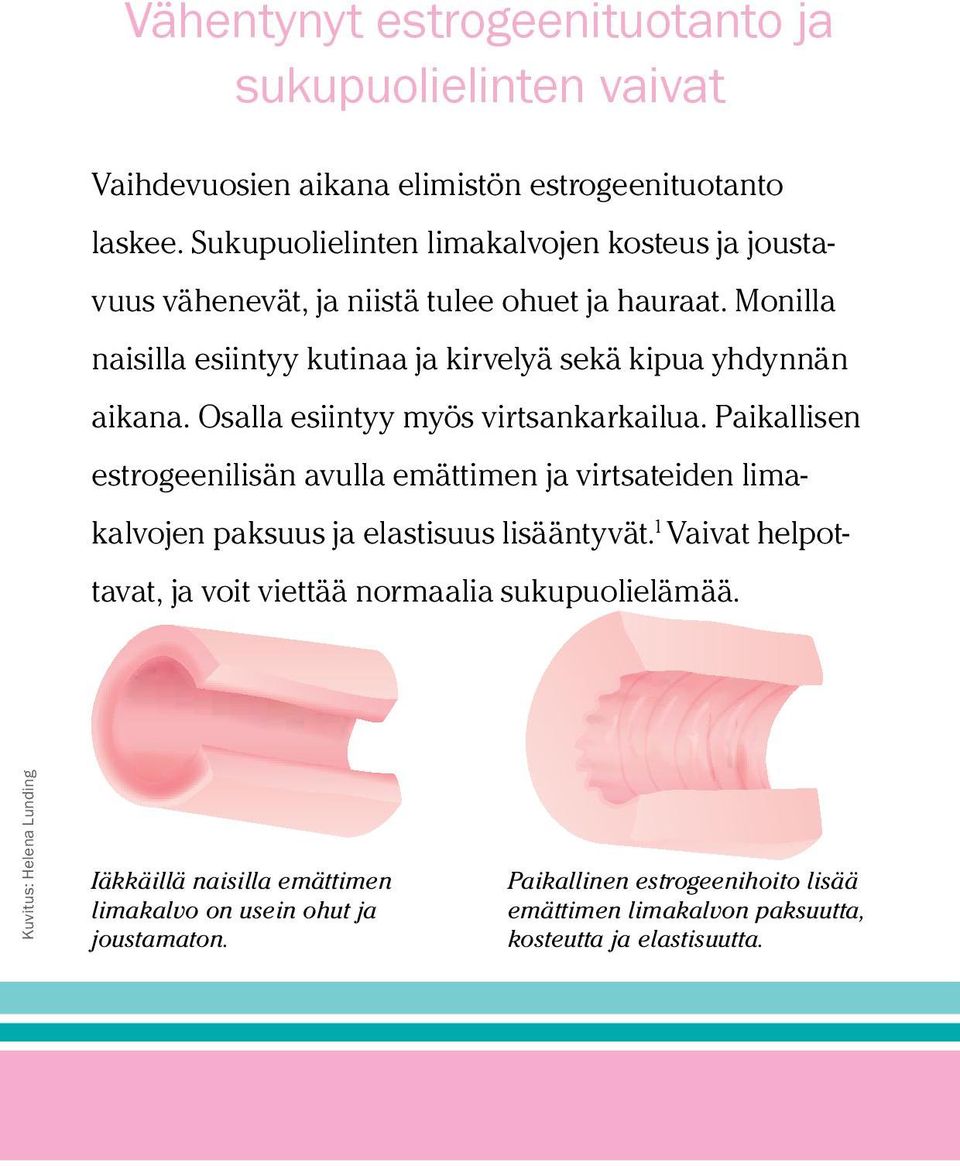 Osalla esiintyy myös virtsankarkailua. Paikallisen estrogeenilisän avulla emättimen ja virtsateiden limakalvojen paksuus ja elastisuus lisääntyvät.