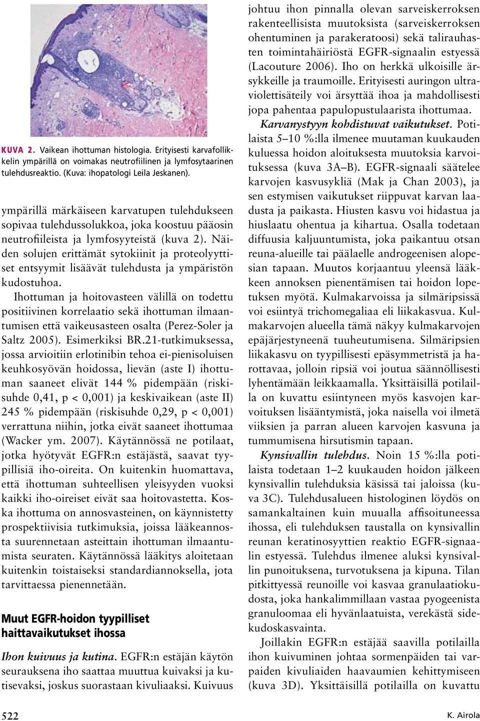 Näiden solujen erittämät sytokiinit ja proteolyyttiset entsyymit lisäävät tulehdusta ja ympäristön kudostuhoa.