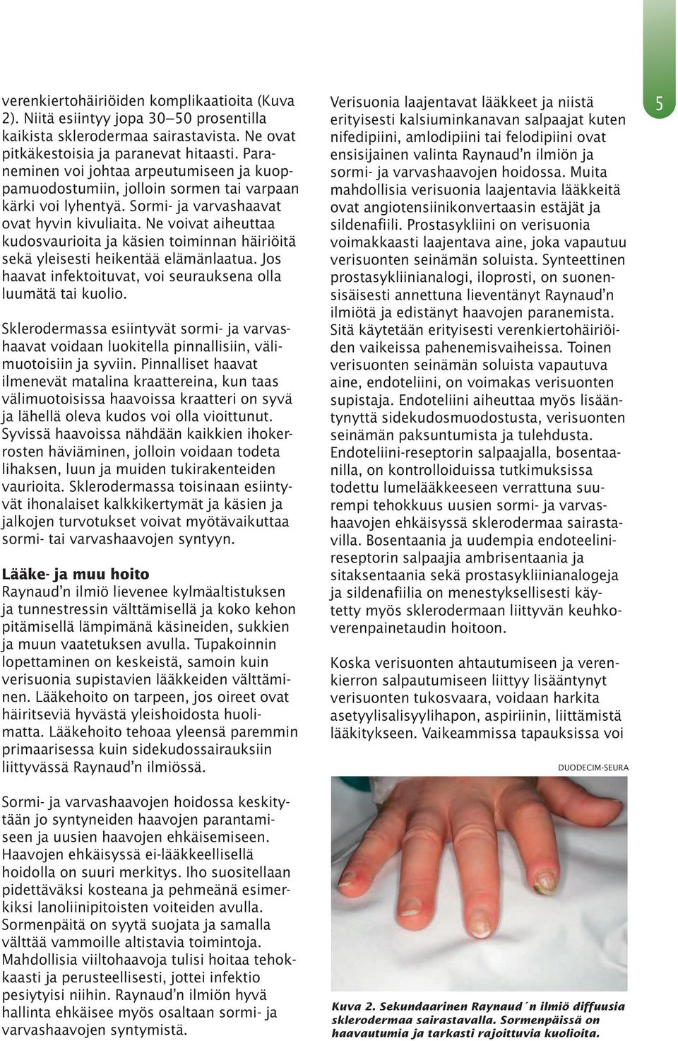 Ne voivat aiheuttaa kudosvaurioita ja käsien toiminnan häiriöitä sekä yleisesti heikentää elämänlaatua. Jos haavat infektoituvat, voi seurauksena olla luumätä tai kuolio.