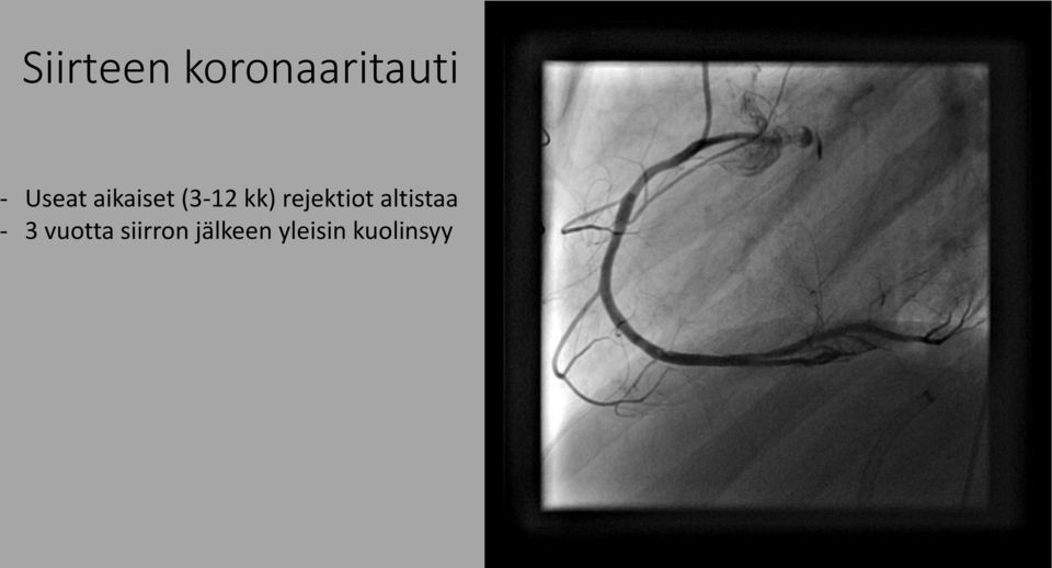 rejektiot altistaa - 3