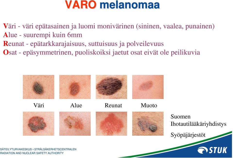 suttuisuus ja polveilevuus Osat - epäsymmetrinen, puoliskoiksi jaetut osat