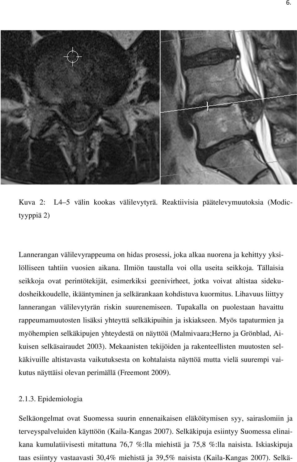 Ilmiön taustalla voi olla useita seikkoja.