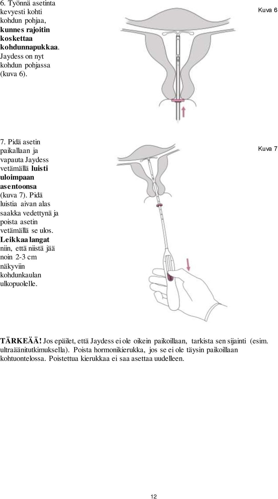 Pidä luistia aivan alas saakka vedettynä ja poista asetin vetämällä se ulos.