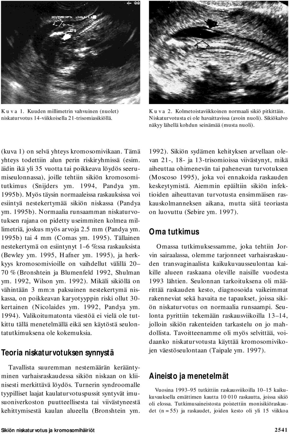 Tämä yhteys todettiin alun perin riskiryhmissä (esim. äidin ikä yli 35 vuotta tai poikkeava löydös seerumiseulonnassa), joille tehtiin sikiön kromosomitutkimus (Snijders ym. 1994, Pandya ym. 1995b).