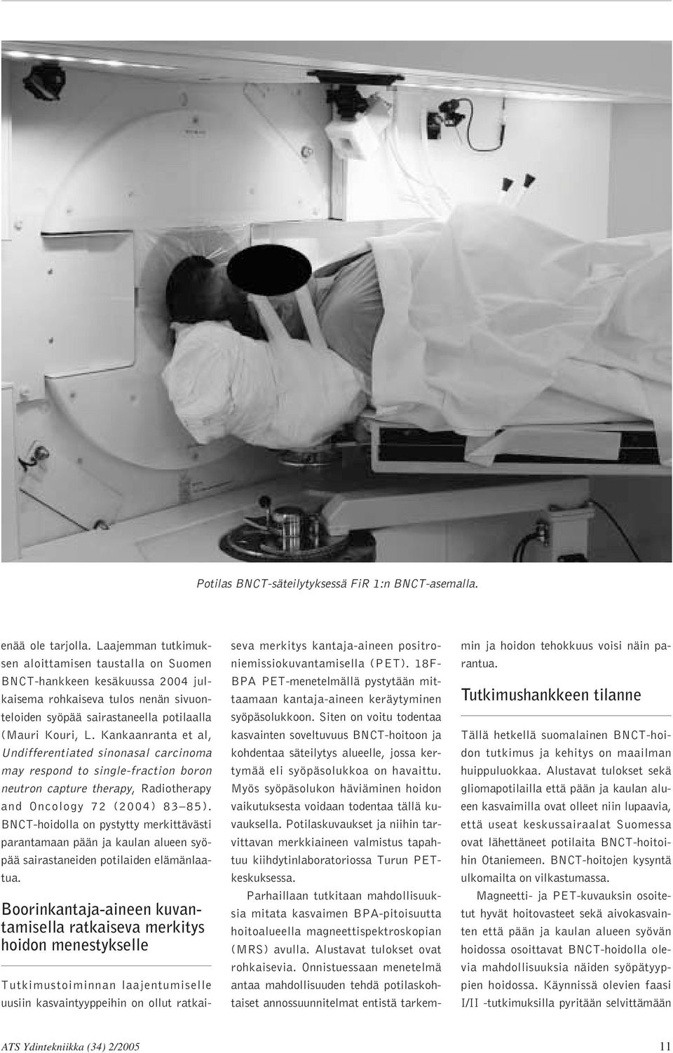 Kankaanranta et al, Undifferentiated sinonasal carcinoma may respond to single-fraction boron neutron capture therapy, Radiotherapy and Oncology 72 (2004) 83 85).