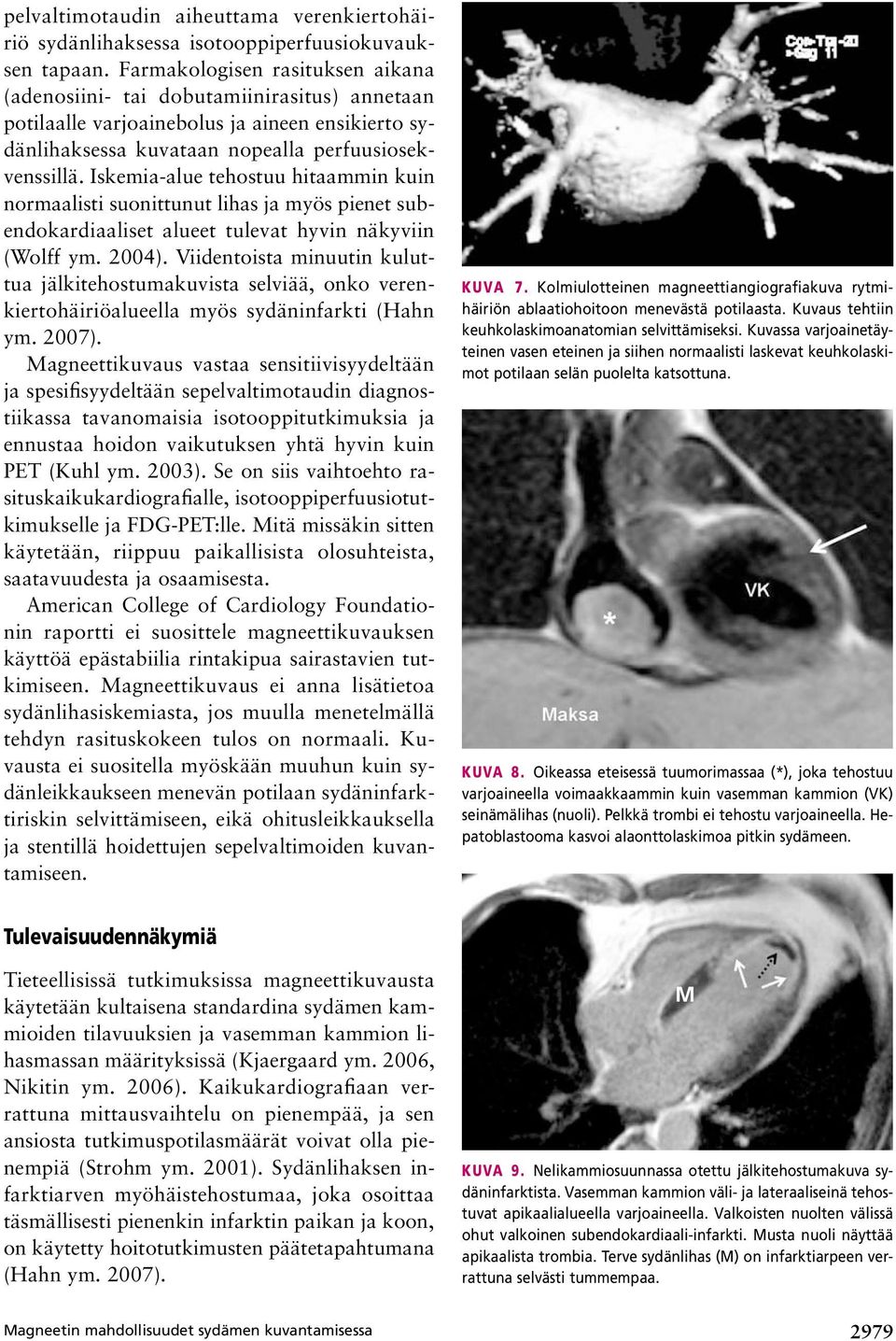 Iskemia-alue tehostuu hitaammin kuin normaalisti suonittunut lihas ja myös pienet subendokardiaaliset alueet tulevat hyvin näkyviin (Wolff ym. 2004).