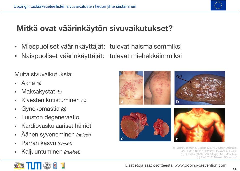 (a) Maksakystat (b) Kivesten kutistuminen (c) Gynekomastia (d) Luuston degeneraatio Kardiovaskulaariset häiriöt Äänen syveneminen (naiset)