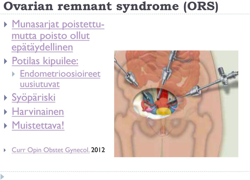 Potilas kipuilee: Endometrioosioireet uusiutuvat