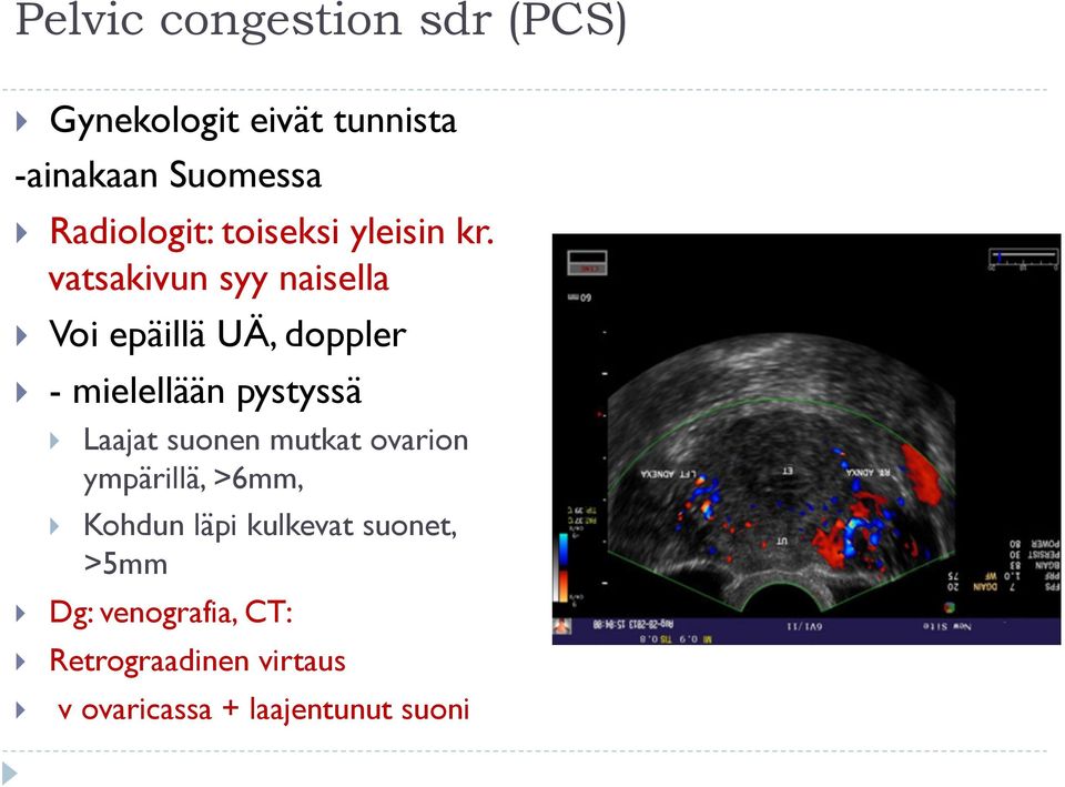 vatsakivun syy naisella Voi epäillä UÄ, doppler - mielellään pystyssä Laajat