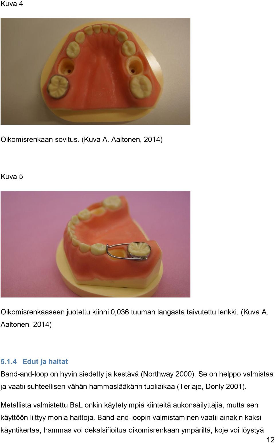 Se on helppo valmistaa ja vaatii suhteellisen vähän hammaslääkärin tuoliaikaa (Terlaje, Donly 2001).