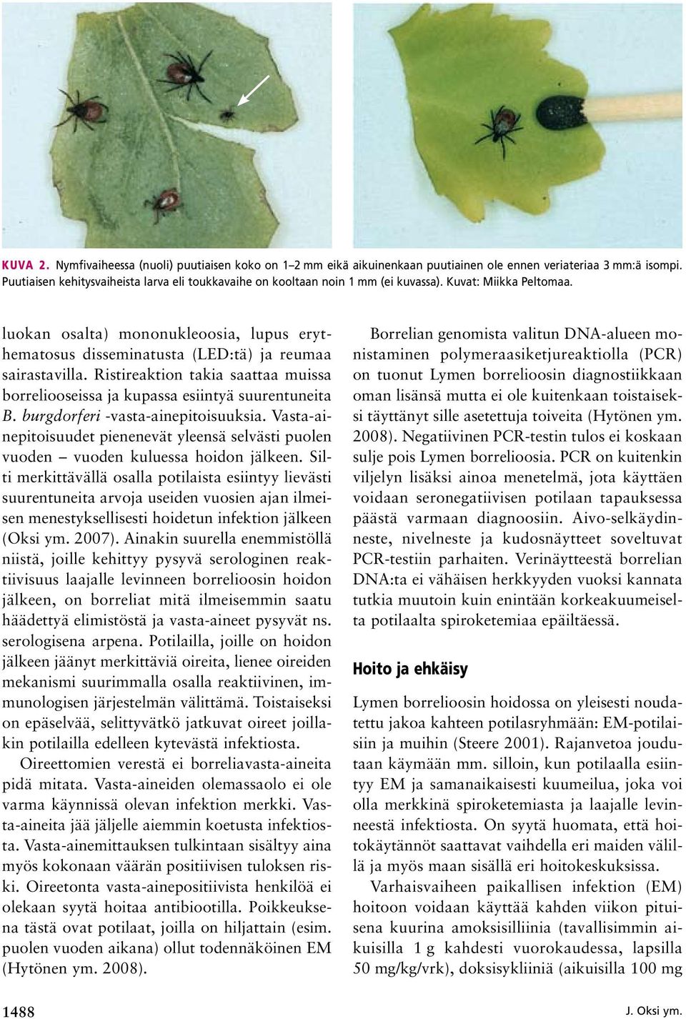 luokan osalta) mononukleoosia, lupus erythematosus disseminatusta (LED:tä) ja reumaa sairastavilla. Ristireaktion takia saattaa muissa borreliooseissa ja kupassa esiintyä suurentuneita B.