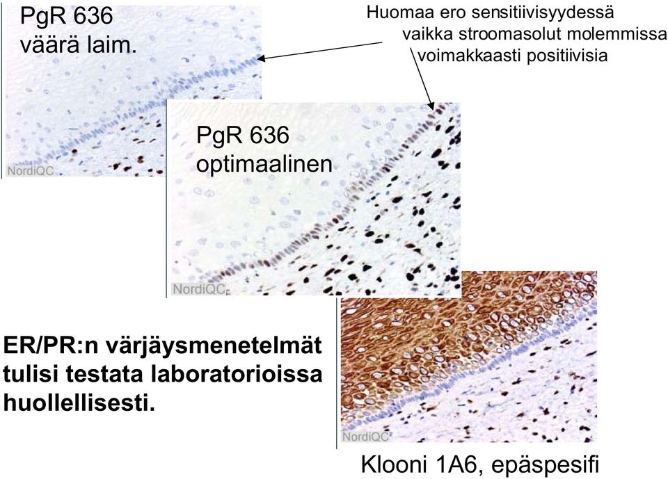 molemmissa voimakkaasti positiivisia PgR 636