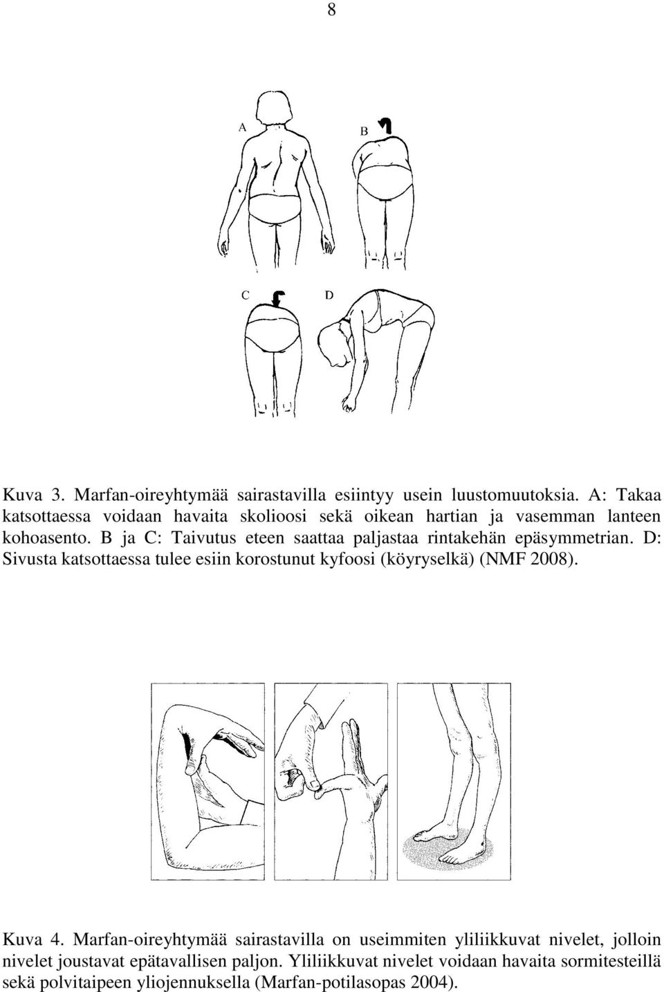 B ja C: Taivutus eteen saattaa paljastaa rintakehän epäsymmetrian.