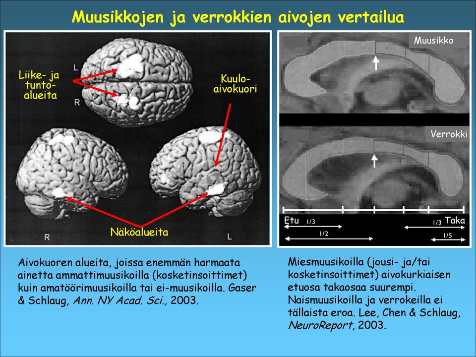 amatöörimuusikoilla tai ei-muusikoilla. Gaser & Schlaug, Ann. NY Acad. Sci., 2003.