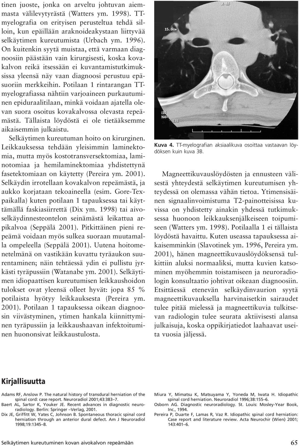 On kuitenkin syytä muistaa, että varmaan diagnoosiin päästään vain kirurgisesti, koska kovakalvon reikä itsessään ei kuvantamistutkimuksissa yleensä näy vaan diagnoosi perustuu epäsuoriin merkkeihin.