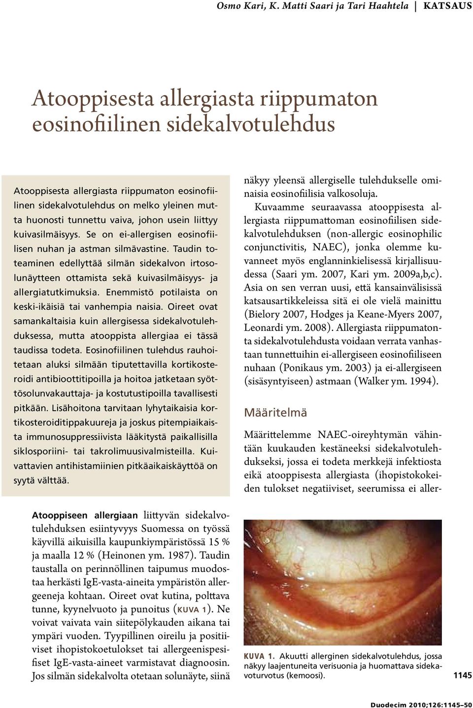 huonosti tunnettu vaiva, johon usein liittyy kuivasilmäisyys. Se on ei-allergisen eosinofiilisen nuhan ja astman silmävastine.