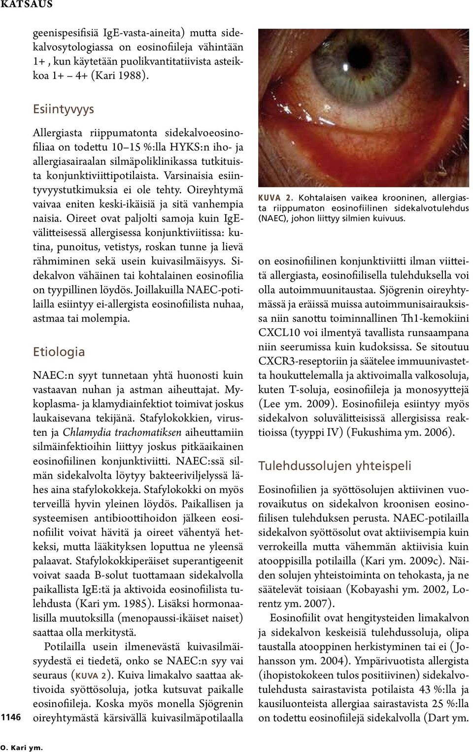 Varsinaisia esiintyvyystutkimuksia ei ole tehty. Oireyhtymä vaivaa eniten keski-ikäisiä ja sitä vanhempia naisia.
