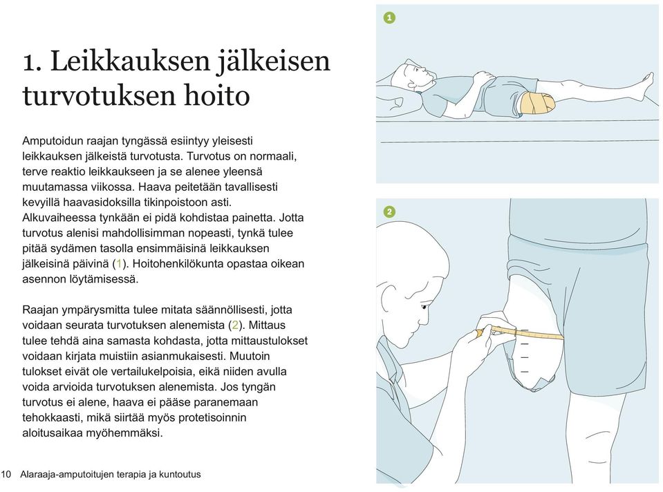 Alkuvaiheessa tynkään ei pidä kohdistaa painetta. Jotta turvotus alenisi mahdollisimman nopeasti, tynkä tulee pitää sydämen tasolla ensimmäisinä leikkauksen jälkeisinä päivinä (1).