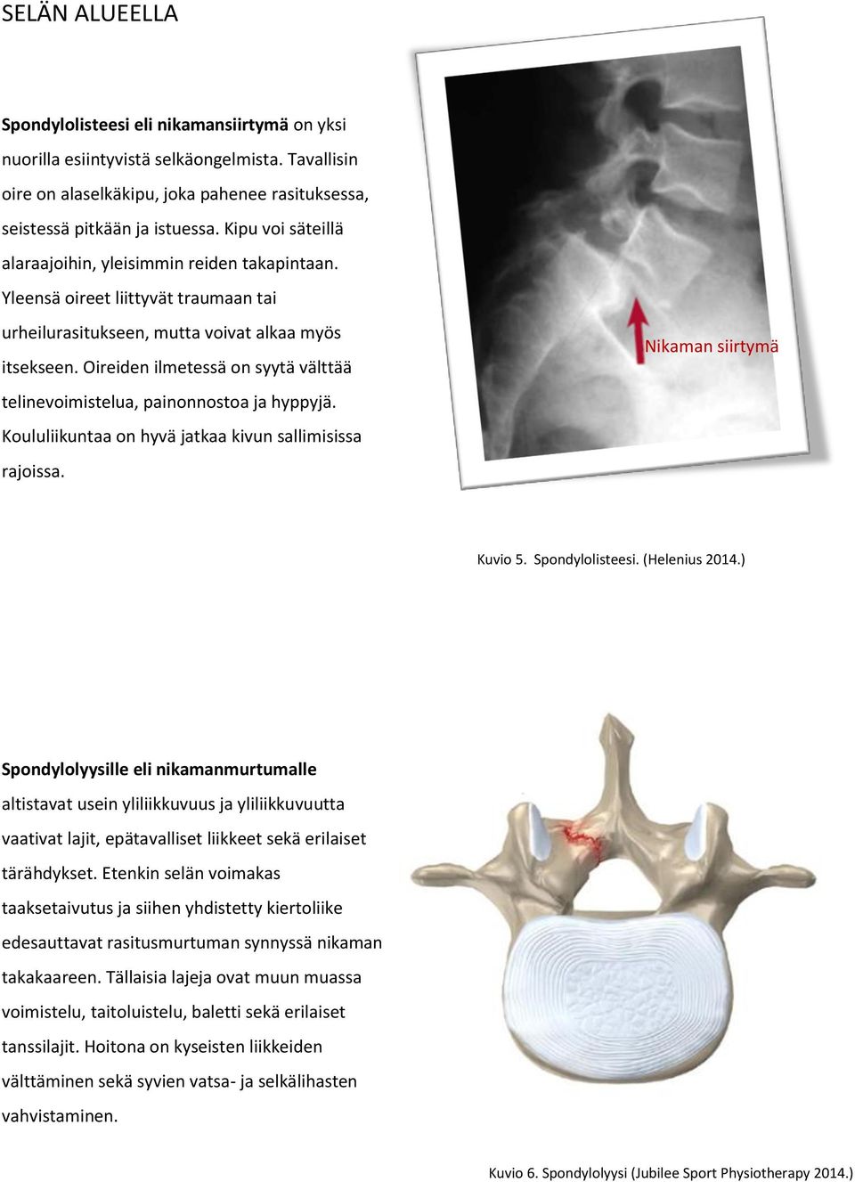 Oireiden ilmetessä on syytä välttää telinevoimistelua, painonnostoa ja hyppyjä. Koululiikuntaa on hyvä jatkaa kivun sallimisissa rajoissa. Nikaman siirtymä Kuvio 5. Spondylolisteesi. (Helenius 2014.