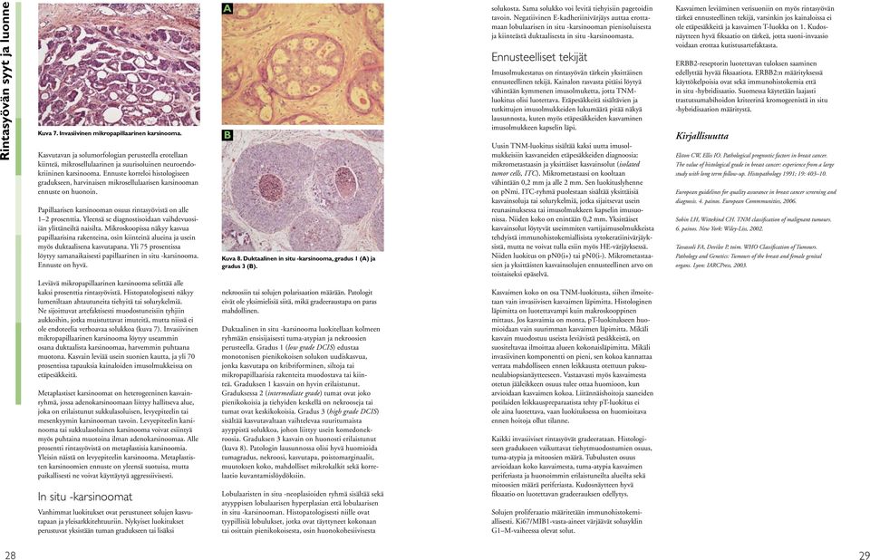 Ennuste korreloi histologiseen gradukseen, harvinaisen mikrosellulaarisen karsinooman ennuste on huonoin. Papillaarisen karsinooman osuus rintasyövistä on alle 1 2 prosenttia.