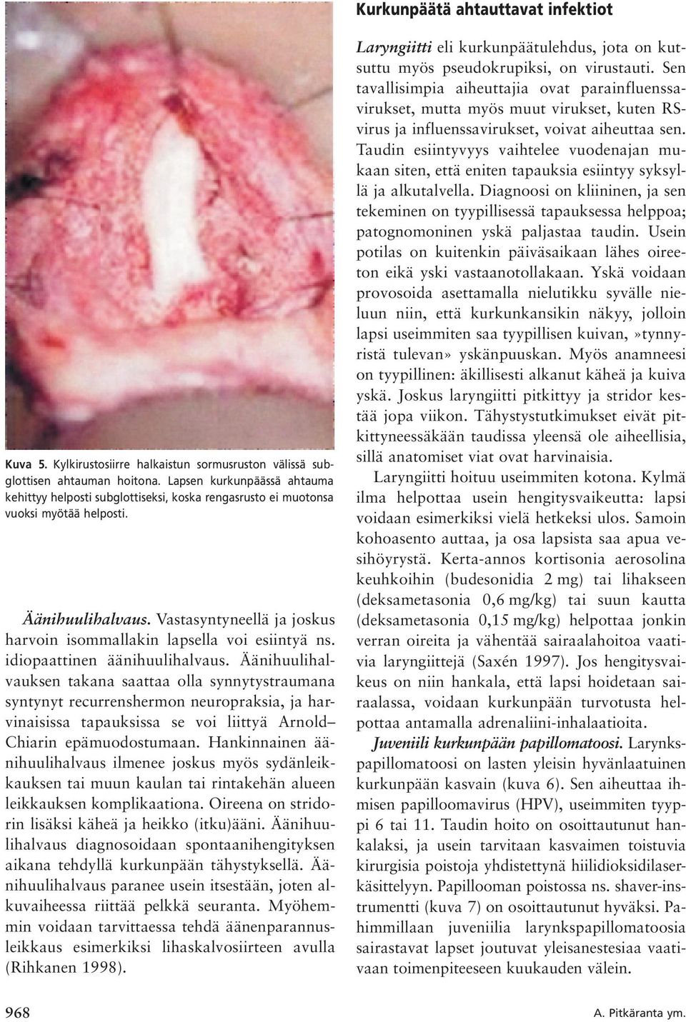 Vastasyntyneellä ja joskus harvoin isommallakin lapsella voi esiintyä ns. idiopaattinen äänihuulihalvaus.