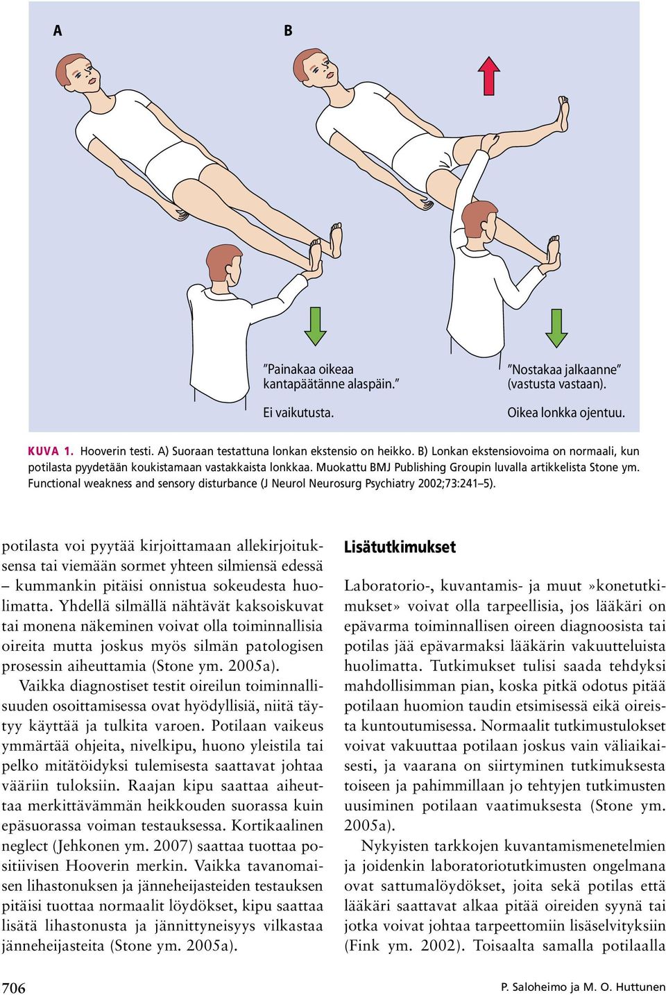 Functional weakness and sensory disturbance (J Neurol Neurosurg Psychiatry 2002;73:241 5).