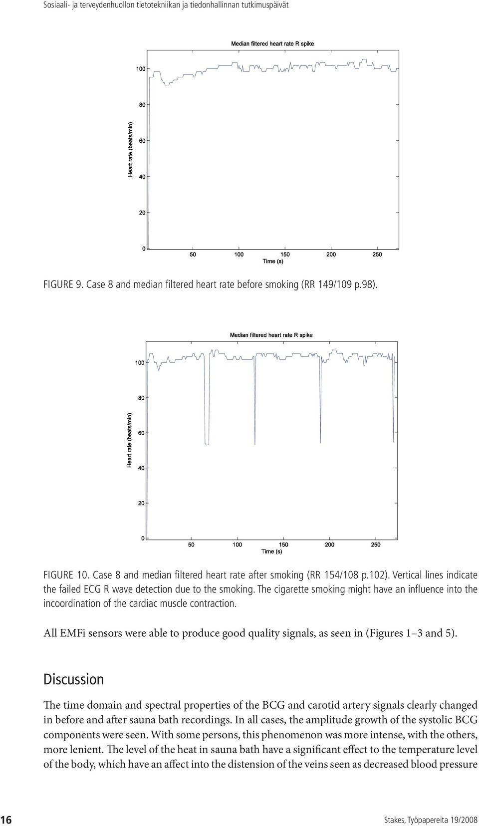 All EMFi sensors were able to produce good quality signals, as seen in (Figures 1 3 and 5).