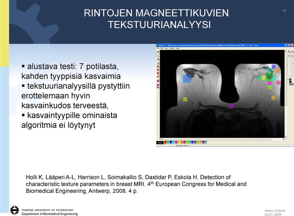 ei löytynyt Holli K, Lääperi A-L, Harrison L, Soimakallio S, Dastidar P, Eskola H, Detection of characteristic