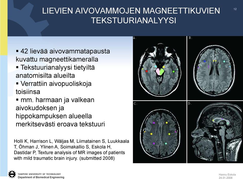 harmaan ja valkean aivokudoksen ja hippokampuksen alueella merkitsevästi eroava tekstuuri Holli K, Harrison L, Wäljas M,