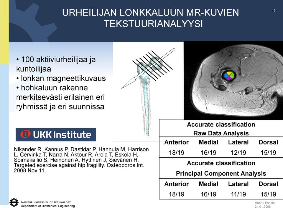 Heinonen A, Hyttinen J, Sievänen H, Targeted exercise against hip fragility. Osteoporos Int. 2008 Nov 11.