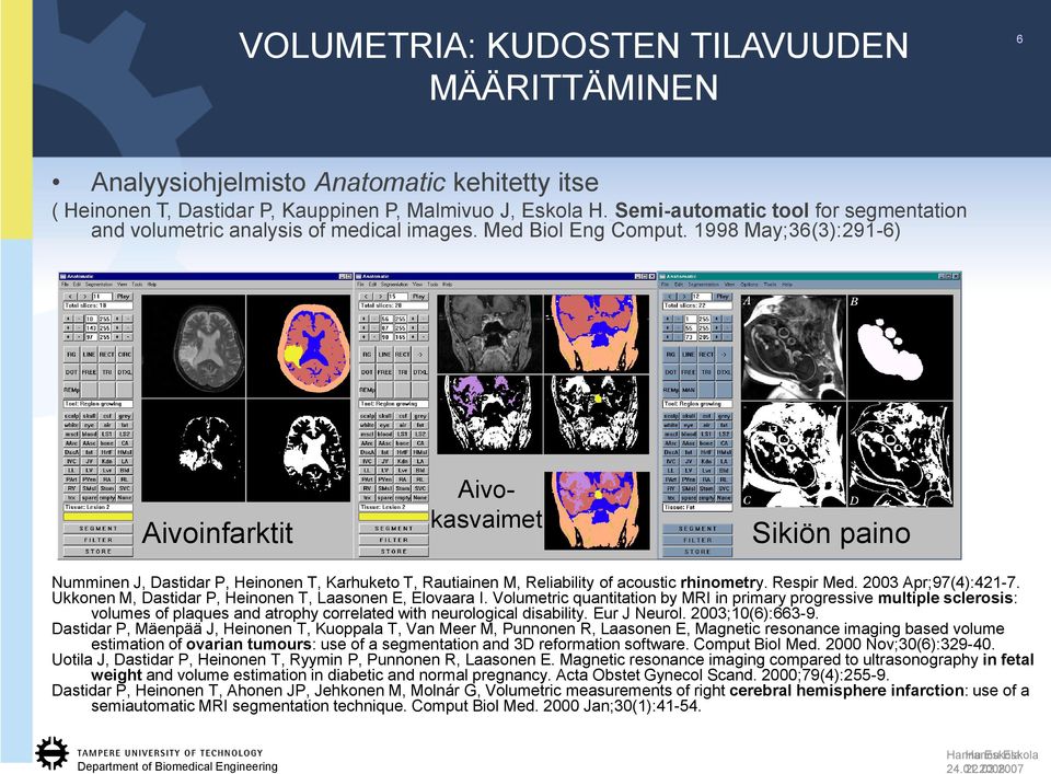 2007 Sikiön paino Numminen J, Dastidar P, Heinonen T, Karhuketo T, Rautiainen M, Reliability of acoustic rhinometry. Respir Med. 2003 Apr;97(4):421-7.