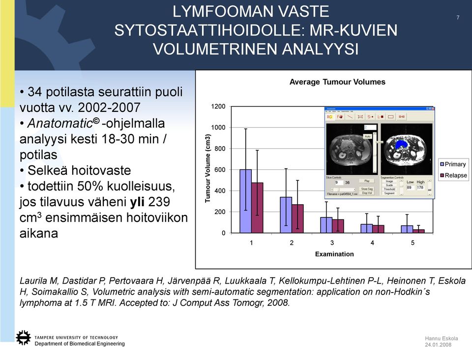 aikana 1200 1000 800 600 400 200 0 Average Tumour Volumes 1 2 3 4 5 Primary Relapse Examination Laurila M, Dastidar P, Pertovaara H, Järvenpää R, Luukkaala T,