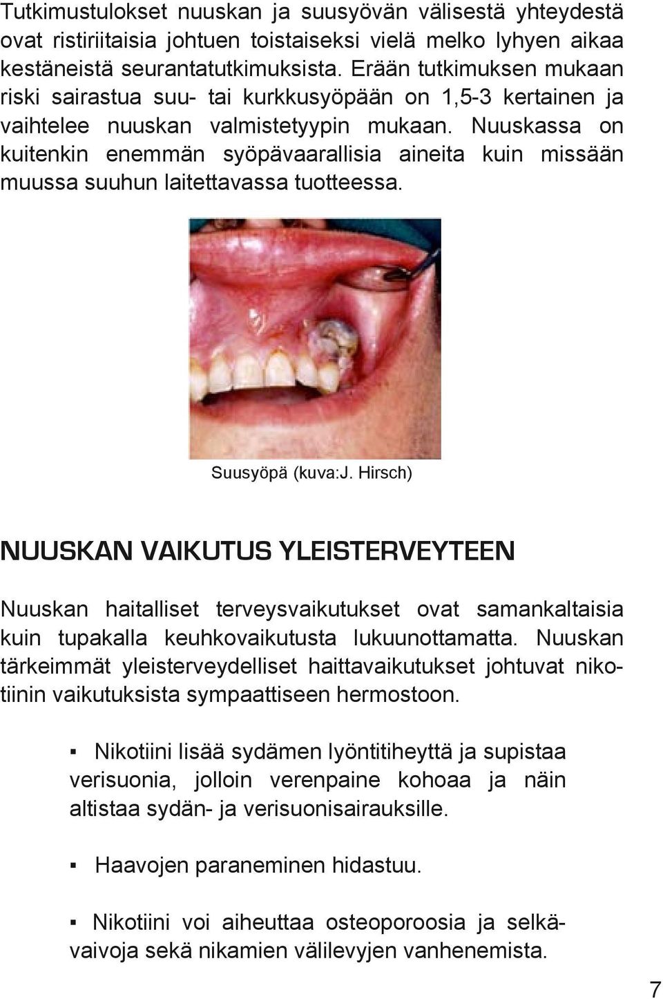 Nuuskassa on kuitenkin enemmän syöpävaarallisia aineita kuin missään muussa suuhun laitettavassa tuotteessa. Suusyöpä (kuva:j.