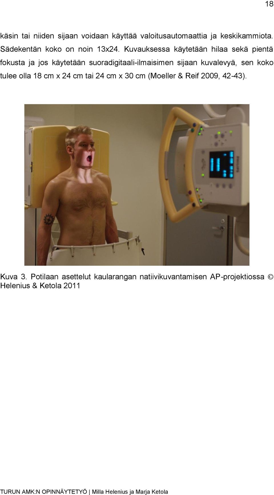 Kuvauksessa käytetään hilaa sekä pientä fokusta ja jos käytetään suoradigitaali-ilmaisimen sijaan