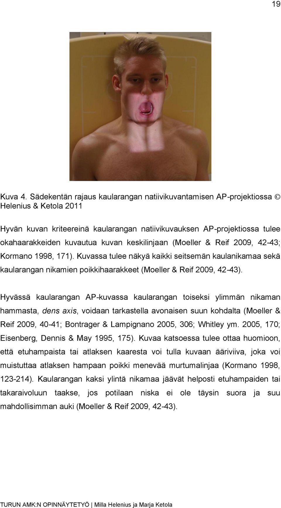 keskilinjaan (Moeller & Reif 2009, 42-43; Kormano 1998, 171). Kuvassa tulee näkyä kaikki seitsemän kaulanikamaa sekä kaularangan nikamien poikkihaarakkeet (Moeller & Reif 2009, 42-43).