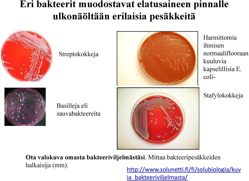 coli- Basilleja eli sauvabakteereita Stafylokokkeja Ota valokuva omasta