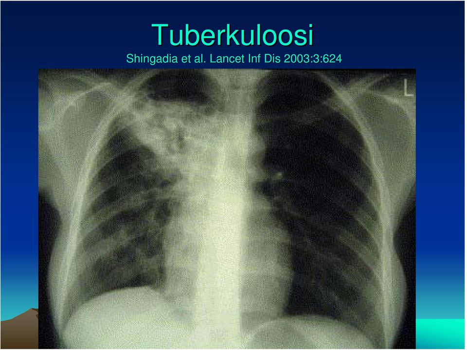 al. Lancet