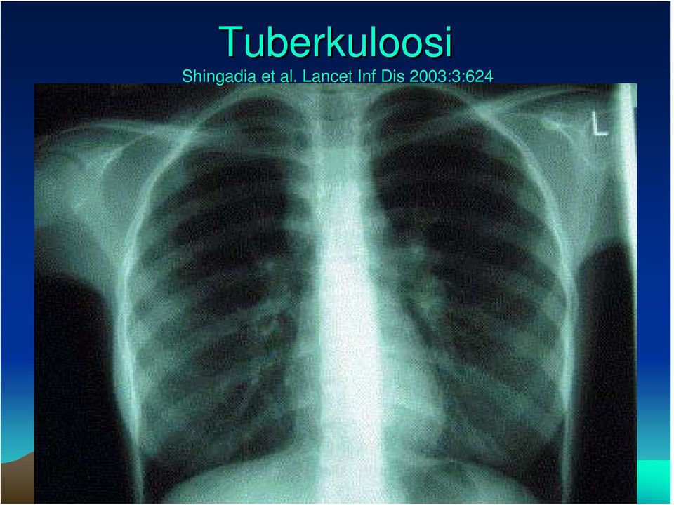 al. Lancet